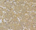 NDUFS3 Polyclonal Antibody