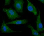 N-WASP Polyclonal Antibody