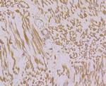 RyR1 Polyclonal Antibody
