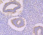 CACNB3 Polyclonal Antibody