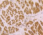 CACNG1 Polyclonal Antibody