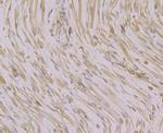CACNB1 Polyclonal Antibody
