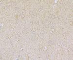 ASIC1 Antibody in Immunohistochemistry (Paraffin) (IHC (P))