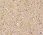 ASIC1 Polyclonal Antibody