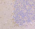 KIF3A Polyclonal Antibody