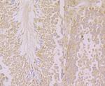 KIF3A Antibody in Immunohistochemistry (Paraffin) (IHC (P))