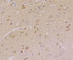 CNGA2 Polyclonal Antibody