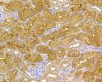 CP013 Antibody in Immunohistochemistry (Paraffin) (IHC (P))