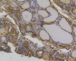 CP013 Antibody in Immunohistochemistry (Paraffin) (IHC (P))