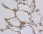 CP013 Antibody in Immunohistochemistry (Paraffin) (IHC (P))