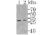 TMEM248 Antibody in Western Blot (WB)