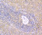 CD40 Antibody in Immunohistochemistry (Paraffin) (IHC (P))