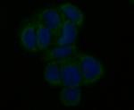 MCU Polyclonal Antibody