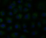 MCU Antibody in Immunocytochemistry (ICC/IF)