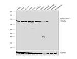 alpha Actinin 1 Antibody in Western Blot (WB)