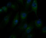 alpha Actinin 1 Polyclonal Antibody