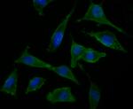 NRCAM Polyclonal Antibody