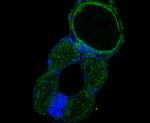 GTSF1 Antibody in Immunohistochemistry (Paraffin) (IHC (P))
