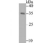 GTSF1 Antibody in Western Blot (WB)