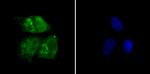 RAD21 Polyclonal Antibody
