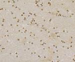 RAD21 Antibody in Immunohistochemistry (Paraffin) (IHC (P))