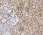 Cytokeratin 7 Antibody in Immunohistochemistry (Paraffin) (IHC (P))