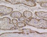 Cytokeratin 7 Antibody in Immunohistochemistry (Paraffin) (IHC (P))