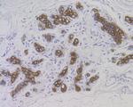 Cytokeratin 7 Antibody in Immunohistochemistry (Paraffin) (IHC (P))