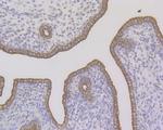 Cytokeratin 7 Antibody in Immunohistochemistry (Paraffin) (IHC (P))
