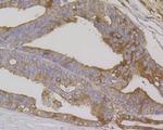 Cytokeratin 7 Antibody in Immunohistochemistry (Paraffin) (IHC (P))