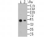 Cytokeratin 7 Antibody in Western Blot (WB)