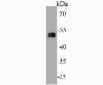 Cytokeratin 7 Antibody in Western Blot (WB)