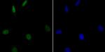 GPR30 Polyclonal Antibody