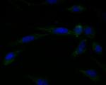 Connexin 45 Polyclonal Antibody