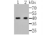 MICA/B Polyclonal Antibody