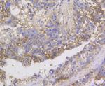 CDH17 Antibody in Immunohistochemistry (Paraffin) (IHC (P))
