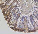 CDH17 Antibody in Immunohistochemistry (Paraffin) (IHC (P))