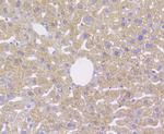 CD163 Antibody in Immunohistochemistry (Paraffin) (IHC (P))
