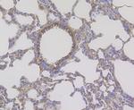CD163 Antibody in Immunohistochemistry (Paraffin) (IHC (P))