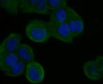 STIM2 Antibody in Immunocytochemistry (ICC/IF)