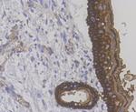 Cytokeratin 14 Antibody in Immunohistochemistry (Paraffin) (IHC (P))