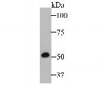 Cytokeratin 14 Antibody in Western Blot (WB)