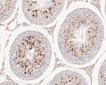 SSRP1 Antibody in Immunohistochemistry (Paraffin) (IHC (P))