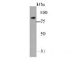 SSRP1 Antibody in Western Blot (WB)