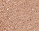B3GAT1 Antibody in Immunohistochemistry (Paraffin) (IHC (P))
