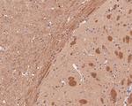 B3GAT1 Polyclonal Antibody