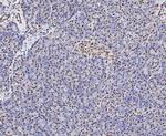 SSB Polyclonal Antibody