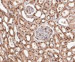SSB Antibody in Immunohistochemistry (Paraffin) (IHC (P))