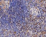 CD68 Antibody in Immunohistochemistry (Paraffin) (IHC (P))