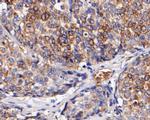 CD68 Antibody in Immunohistochemistry (Paraffin) (IHC (P))